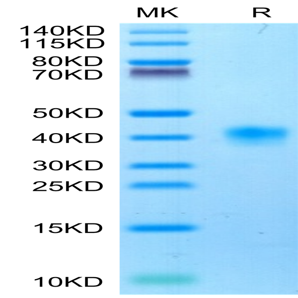Cynomolgus LILRB4/CD85k/ILT3 Protein (LIL-CM1B4)
