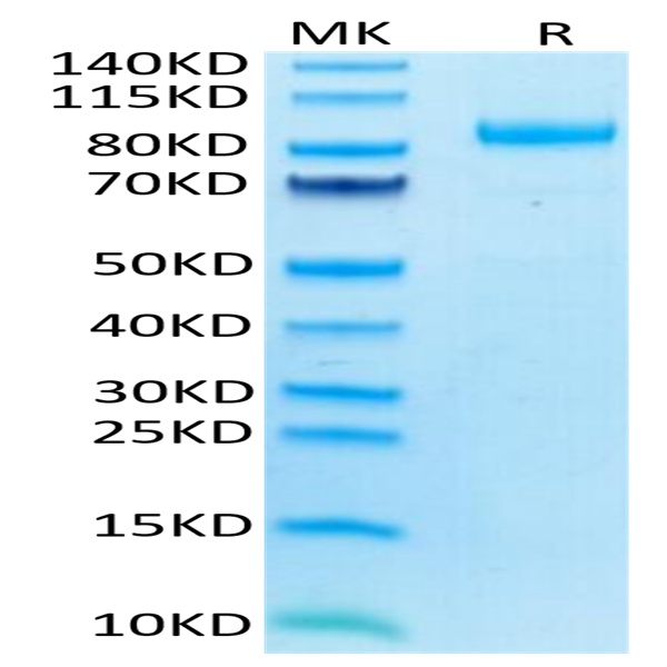 Human LILRB2/CD85d/ILT4 Protein (LIL-HM3B2)
