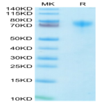 Human LILRA1/CD85i/LIR-6 Protein (LIL-HM4A1)