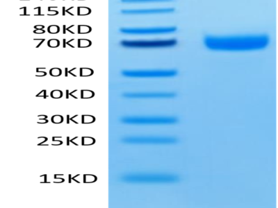 Human LILRA3/CD85e Protein (LIL-HM4A3)