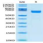 Human LILRA4/CD85g Protein (LIL-HM4A4)
