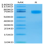 Biotinylated Human LILRA6/CD85b/ILT8 Protein (LIL-HM4A6B)