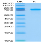 Human LILRB2/CD85d/ILT4 Protein (LIL-HM4B2)
