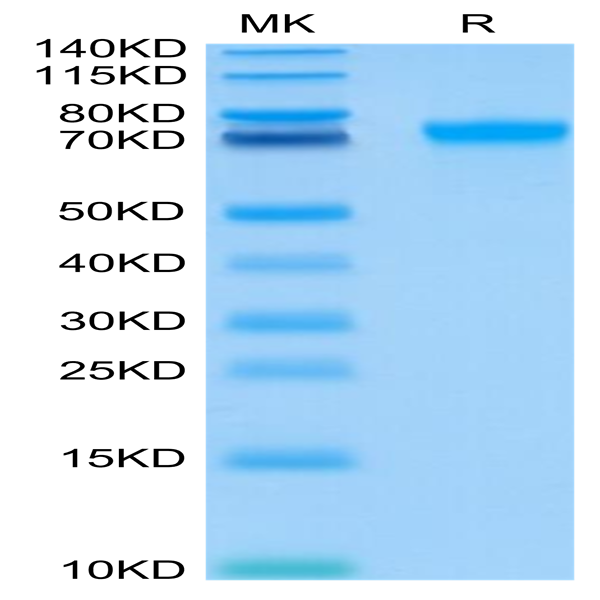 Human LILRB2/CD85d/ILT4 Protein (LIL-HM4B2)