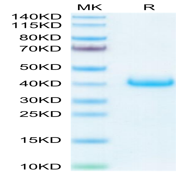 Biotinylated Human LILRB4/CD85k/ILT3 Protein (LIL-HM4B4B)