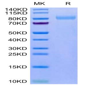 Mouse LRRN1 Protein (LNR-MM101)