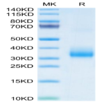 Human LOX1 Protein (LOX-HM101)