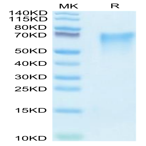 Human LYPD3 Protein (LPD-HM103)