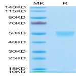 Human LRG1 Protein (LRG-HM101)