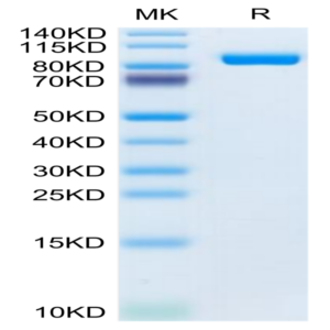 Mouse LRIG1 Protein (LRI-MM101)