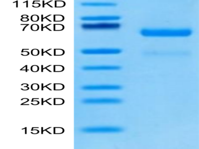 Human LRP10 Protein (LRP-HM110)