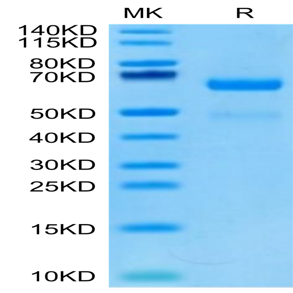 Human LRP10 Protein (LRP-HM110) Human LRP10 Protein (LRP-HM110)