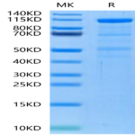 Human LRP-6 Protein (LRP-HM306)