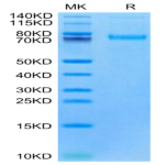 Cynomolgus/Rhesus macaque LRRC15/LIB Protein (LRR-CM115)