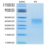 Human LRRC52 Protein (LRR-HM152)