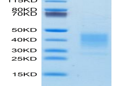 Human LRRC52 Protein (LRR-HM152)