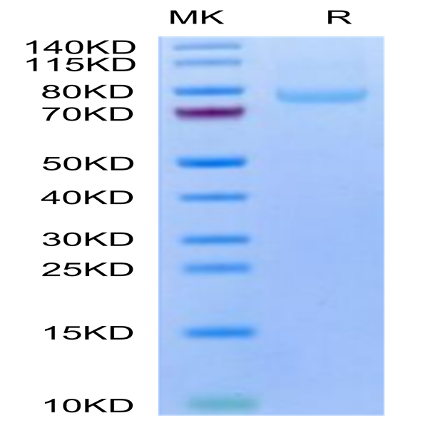 Human LRRC15/LIB Protein (LRR-HM415)