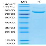 Biotinylated Human LRRC15/LIB Protein (LRR-HM415B)