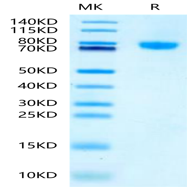 Mouse LRRC15/LIB Protein (LRR-MM115)