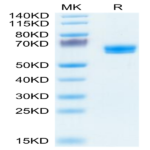 Human LTBR Protein (LTB-HM201)