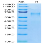 Human LTK Potein (LTK-HM101)