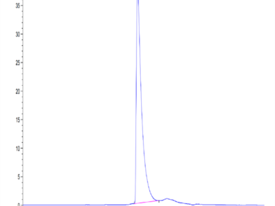 Human CD229/SLAMF3 Protein (LY9-HM401)