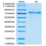 Human CD229/SLAMF3 Protein (LY9-HM401)
