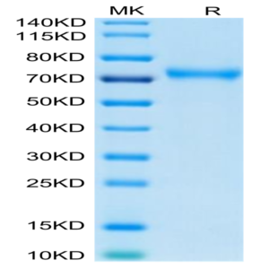 Human CD229/SLAMF3 Protein (LY9-HM401)