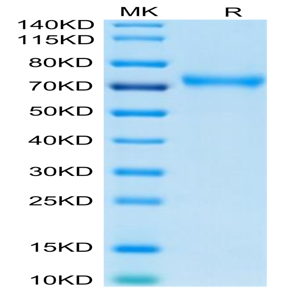 Human CD229/SLAMF3 Protein (LY9-HM401)