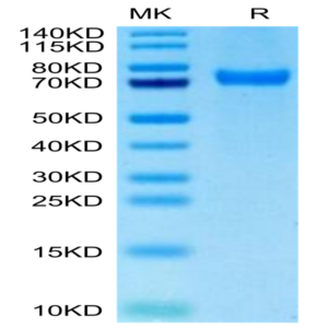 Biotinylated Human CD229/SLAMF3 Protein (LY9-HM401B)