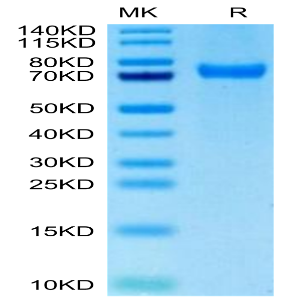 Biotinylated Human CD229/SLAMF3 Protein (LY9-HM401B)