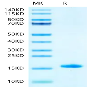 Mouse LY6A Protein (LYA-ME006)
