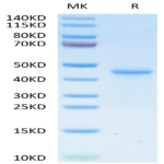 Human LY6G6D Protein (LYD-HM26D)