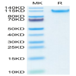 Human MANSC1 Protein (MAN-HM1C1)