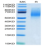 Mouse MANSC1 Protein (MAN-MM1C1)
