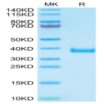 Cynomolgus MFAP4 Protein (MAP-CM104)