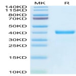 Human MFAP4 Protein (MAP-HM104)