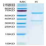 Human MFAP5 Protein (MAP-HM2P5)