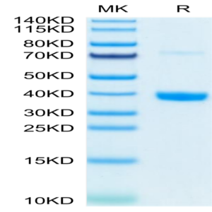 Mouse MFAP4 Protein (MAP-MM104)
