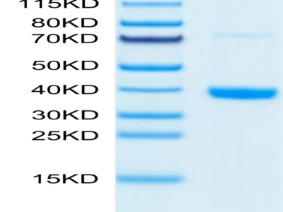 Mouse MFAP4 Protein (MAP-MM104)