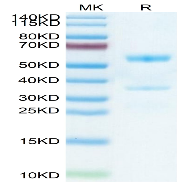 Mouse MFAP5 Protein (MAP-MM2P5)