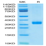 Human MBL2/Mannan Binding Lectin Protein (MBL-HM102)
