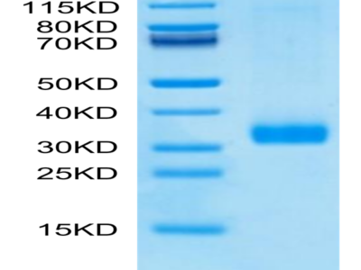 Human MBL2/Mannan Binding Lectin Protein (MBL-HM102)