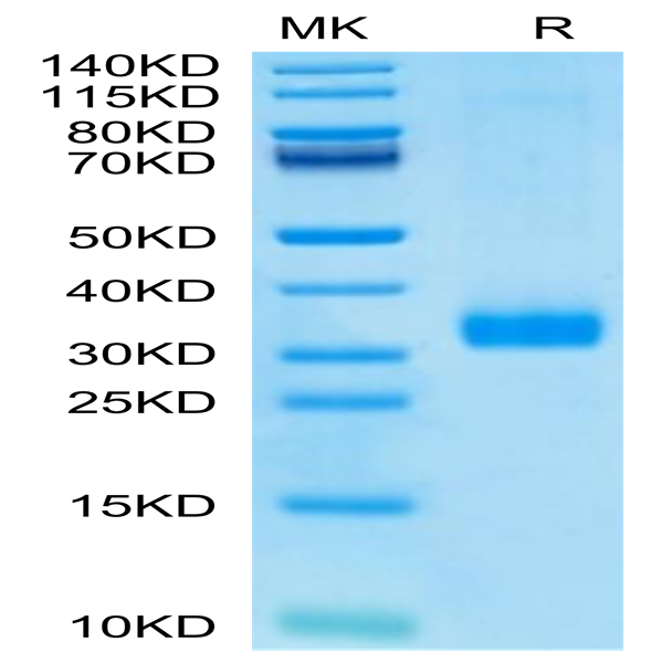 Human MBL2/Mannan Binding Lectin Protein (MBL-HM102) Human MBL2/Mannan Binding Lectin Protein (MBL-HM102)