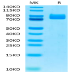 Human MADCAM1 Protein (MCM-HM201)