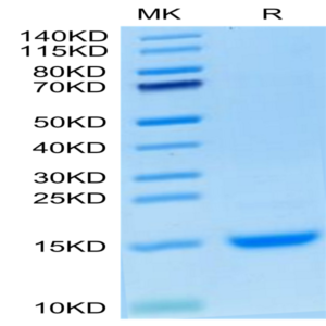 Cynomolgus MCP-1/CCL2 Protein (MCP-CM101)