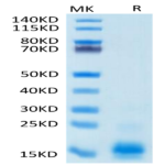 Human MCP-1/CCL2 Protein (MCP-HM401)