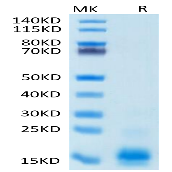 Human MCP-1/CCL2 Protein (MCP-HM401)