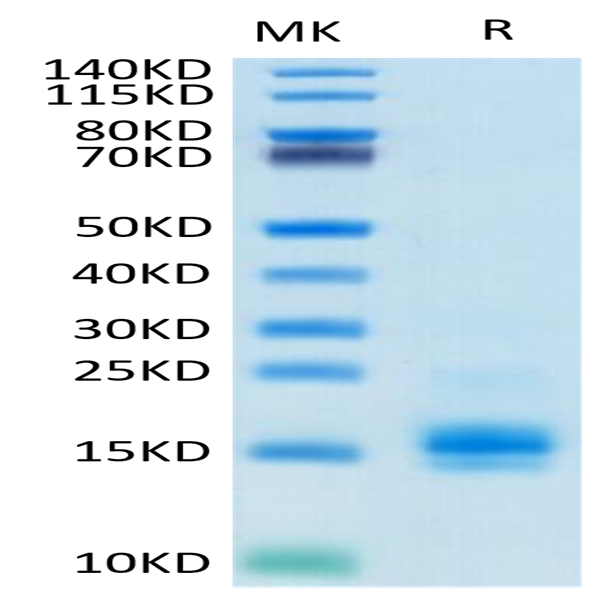 Biotinylated Human MCP-1/CCL2 Protein (MCP-HM401B)