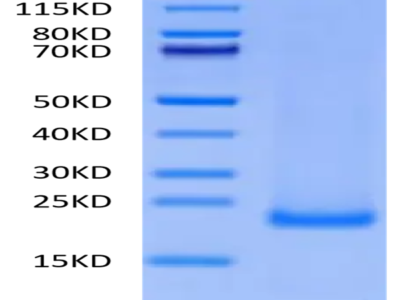 Cynomolgus MD2 Protein (MD2-CE102)